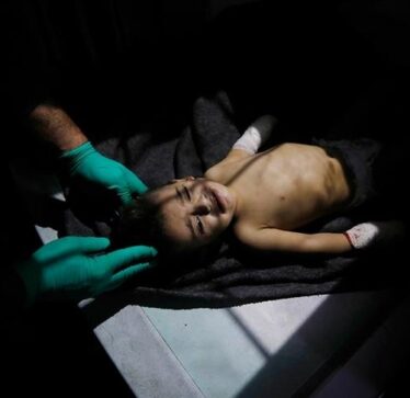 Shumë të rinj amerikanë mendojnë se Izraeli po kryen gjenocid në Gaza