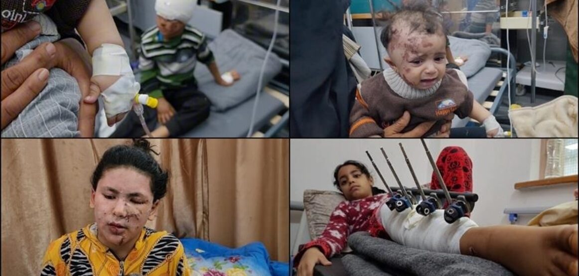 Fëmijët e plagosur nga sulmet izraelite në Gaza rrëfejnë tmerrin e përjetuar