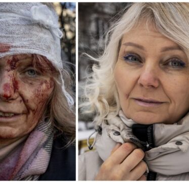 Olena Kurilo, fotografia e së cilës u bë simbol i luftës Rusi-Ukrainë, kthehet në shtëpi në Kharkiv