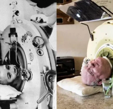 Ka ndërruar jetë burri që jetoi në një mushkëri hekuri për 70 vjet