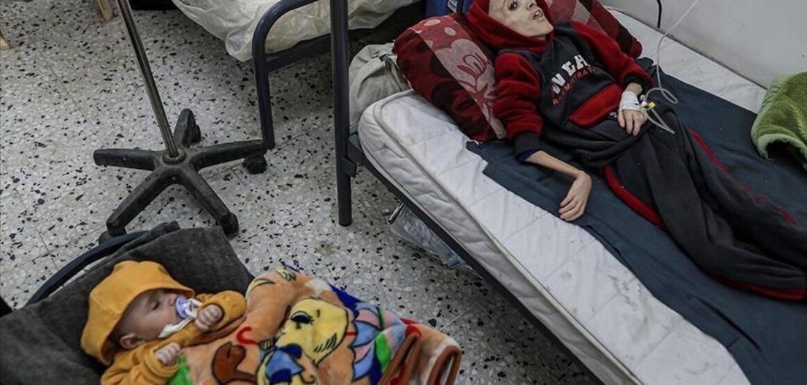 “Bota do të jetë dëshmitare e shumë vdekjeve nga uria në ditët e ardhshme”