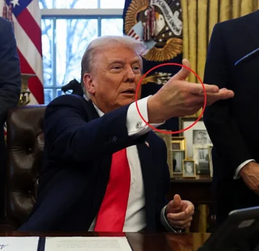Misteri i mavijosjes në dorën e Trump-it ngjall spekulime, Shtëpia e Bardhë fajëson “shtrëngimin e duarve”