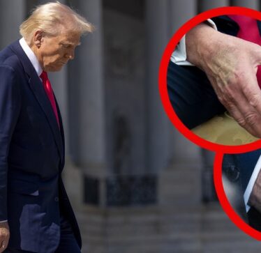 Çfarë është tani në dorën e djathtë të Trumpit?