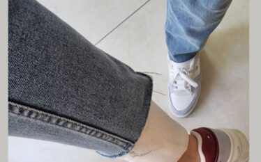 Qytetarja sulmohet nga qeni endacak në Prishtinë, bën thirrje të…