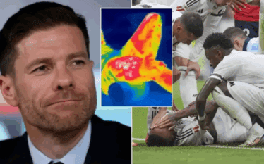 Xabi Alonso gjen mënyrën perfekte për të parashikuar lëndimet te…